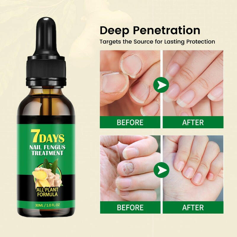 ZILEVA Ginger Nail Rescue Oil | Natural Herbs.